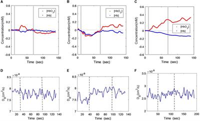 Comprehensive investigations of cerebral hemodynamic responses in CSVD patients with mental disorders: a pilot study